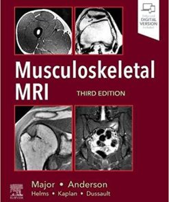Musculoskeletal MRI (Inglés) 3rd