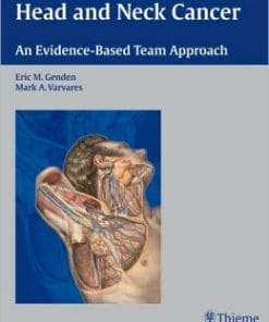 Head and Neck Cancer: An Evidence-Based Team Approach