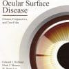 Ocular Surface Disease: Cornea, Conjunctiva and Tear Film