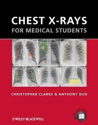 Chest X-rays for Medical Students 1st Edition