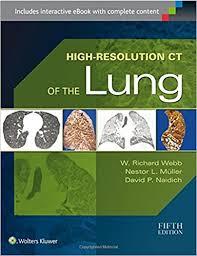 Ebook High-Resolution CT of the Lung 5th Edition