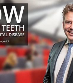 How To Save Teeth With Periodontal Disease