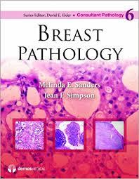 Breast Pathology (Consultant Pathology) 1st Edition