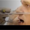 Facebow Transfer