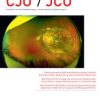 Canadian Journal of Ophthalmology PDF