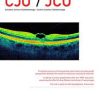 Canadian Journal of Ophthalmology PDF
