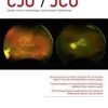 Canadian Journal Of Ophthalmology Volume 58, Issue 5