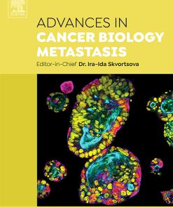 Advances in Cancer Biology - Metastasis PDF