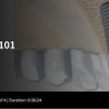 Spear-Implants 101