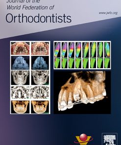 Journal of the World Federation of Orthodontists PDF