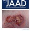 Journal of the American Academy of Dermatology PDF