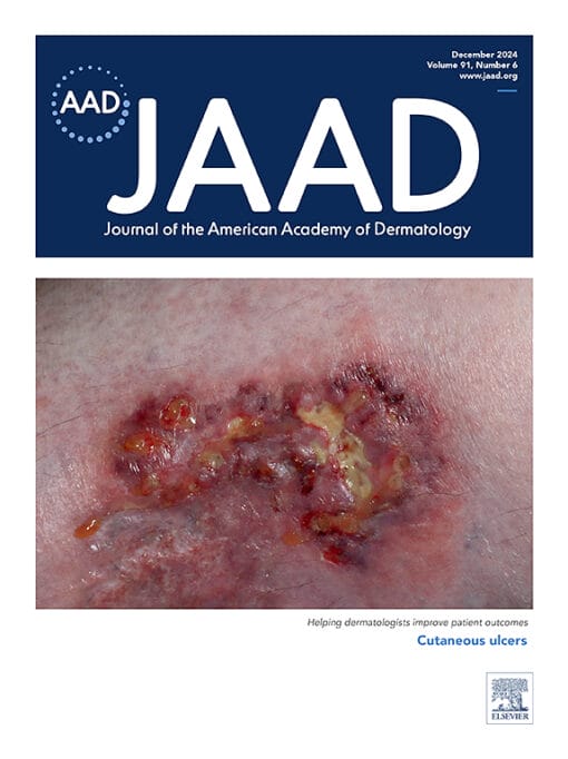 Journal of the American Academy of Dermatology PDF
