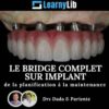 LearnyLib Le Bridge Complet sur Implant – Dada, Pariente de la plantification a la maintenance (Dental course)