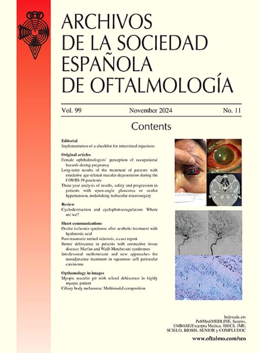 Archivos de la Sociedad Española de Oftalmología (English Edition) PDF