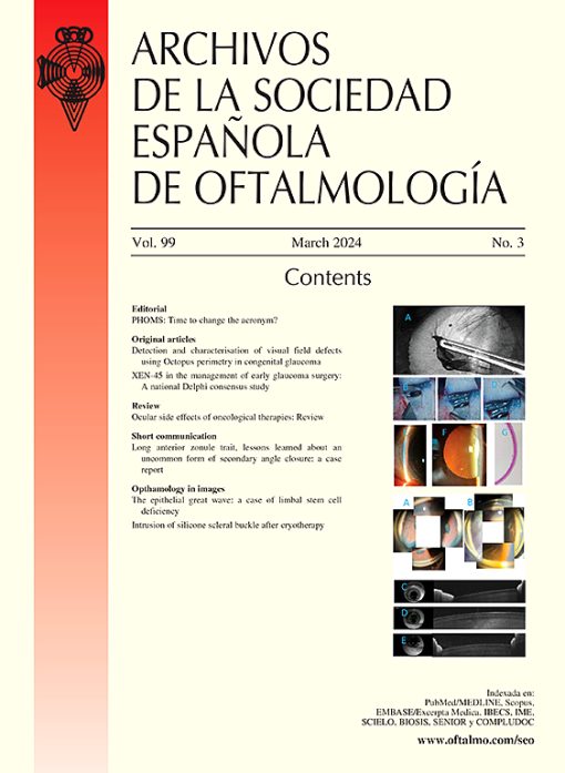 Archivos de la Sociedad Española de Oftalmología (English Edition) PDF