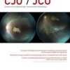 Canadian Journal of Ophthalmology PDF