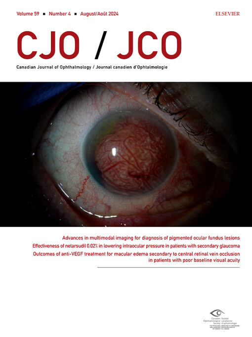 Canadian Journal of Ophthalmology PDF