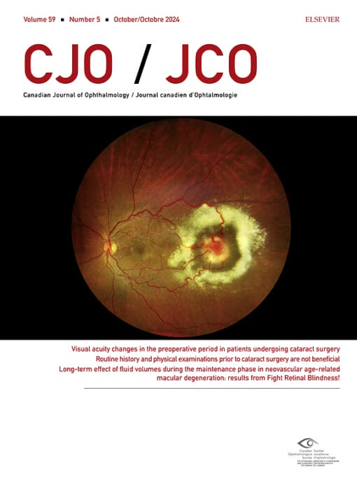 Canadian Journal of Ophthalmology PDF