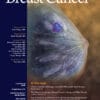 Clinical Breast Cancer PDF