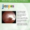 Journal of American Association for Pediatric Ophthalmology and Strabismus PDF