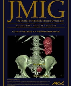 Journal of Minimally Invasive Gynecology PDF