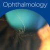 Ophthalmology PDF