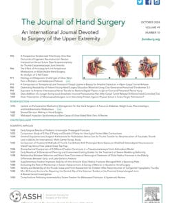 The Journal of Hand Surgery PDF