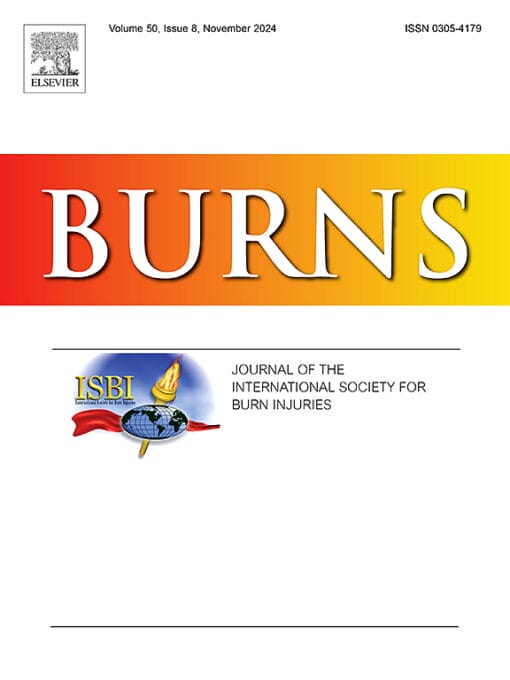 Burns PDF