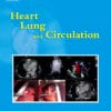 Heart, Lung and Circulation PDF