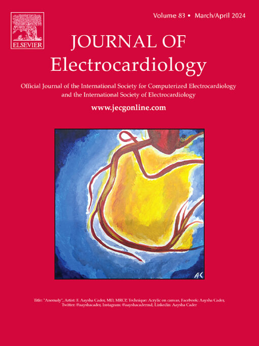 Journal of Electrocardiology PDF