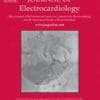 Journal of Electrocardiology PDF