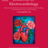 Journal of Electrocardiology PDF