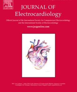 Journal of Electrocardiology PDF