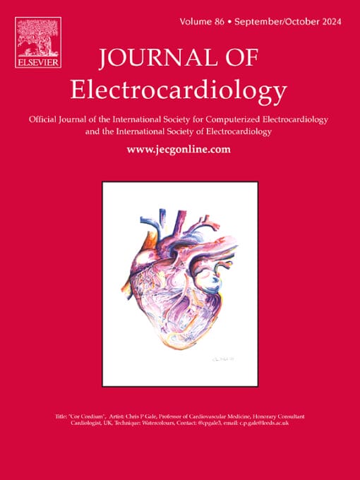 Journal of Electrocardiology PDF