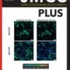 Journal of Molecular and Cellular Cardiology Plus PDF