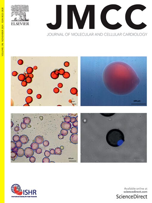 Journal of Molecular and Cellular Cardiology PDF