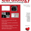 Revista Portuguesa de Cardiologia PDF