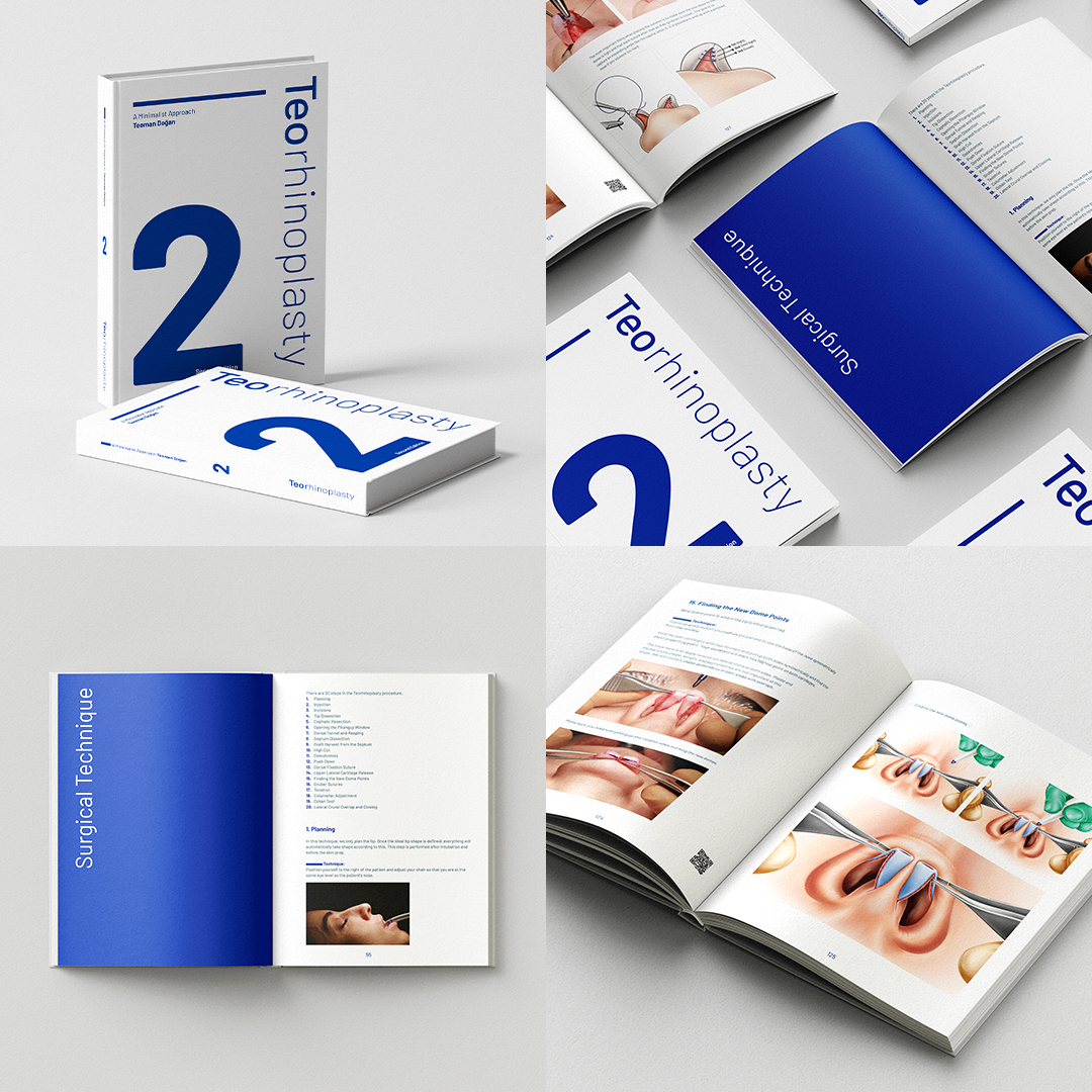 Teorhinoplasty Book 2nd Edition - 2023-2024 (Video) Teorhinoplasty Book