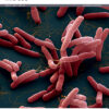 The Lancet Microbe PDF