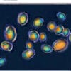 The Lancet Microbe PDF