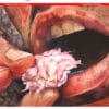 The Lancet Oncology PDF