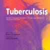 Tuberculosis PDF