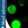Blood Advances PDF