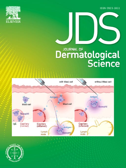 Journal of Dermatological Science PDF