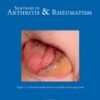 Seminars in Arthritis and Rheumatism PDF