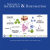 Seminars in Arthritis and Rheumatism PDF