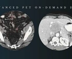 PET On-Demand 2024 – CMEScience (Videos)