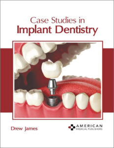 Case Studies in Implant Dentistry