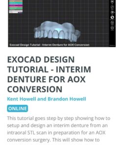 EXOCAD Design Tutorial: Interim Denture For AOX Conversion