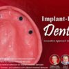 OHI-S Implant-Retained Dentures Innovative Approach to Full-Arch Prosthetics